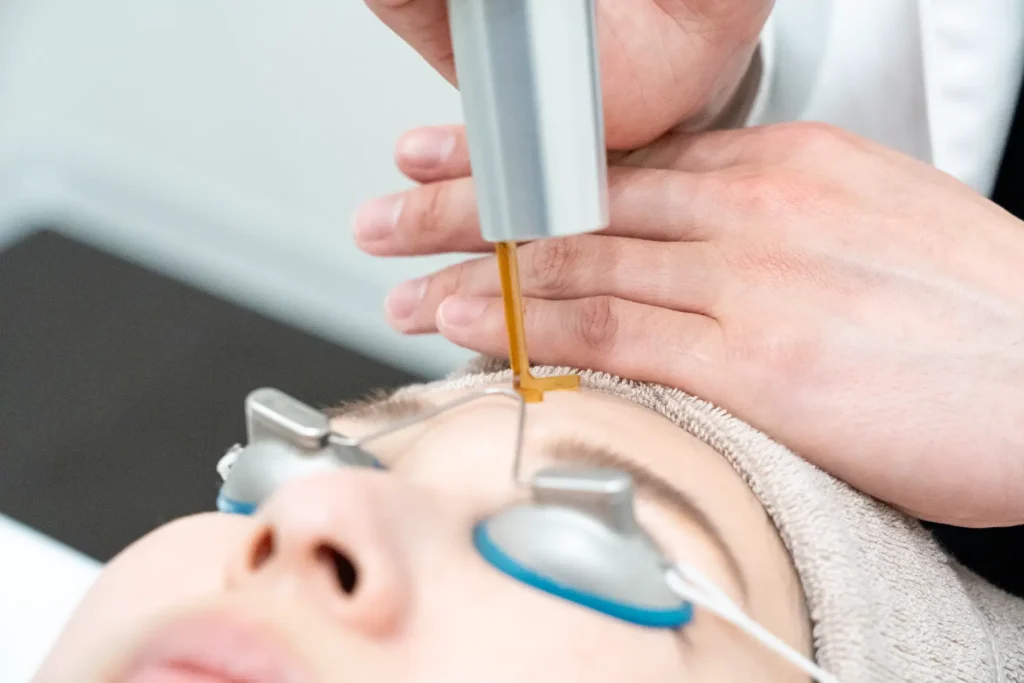 レーザー照射系